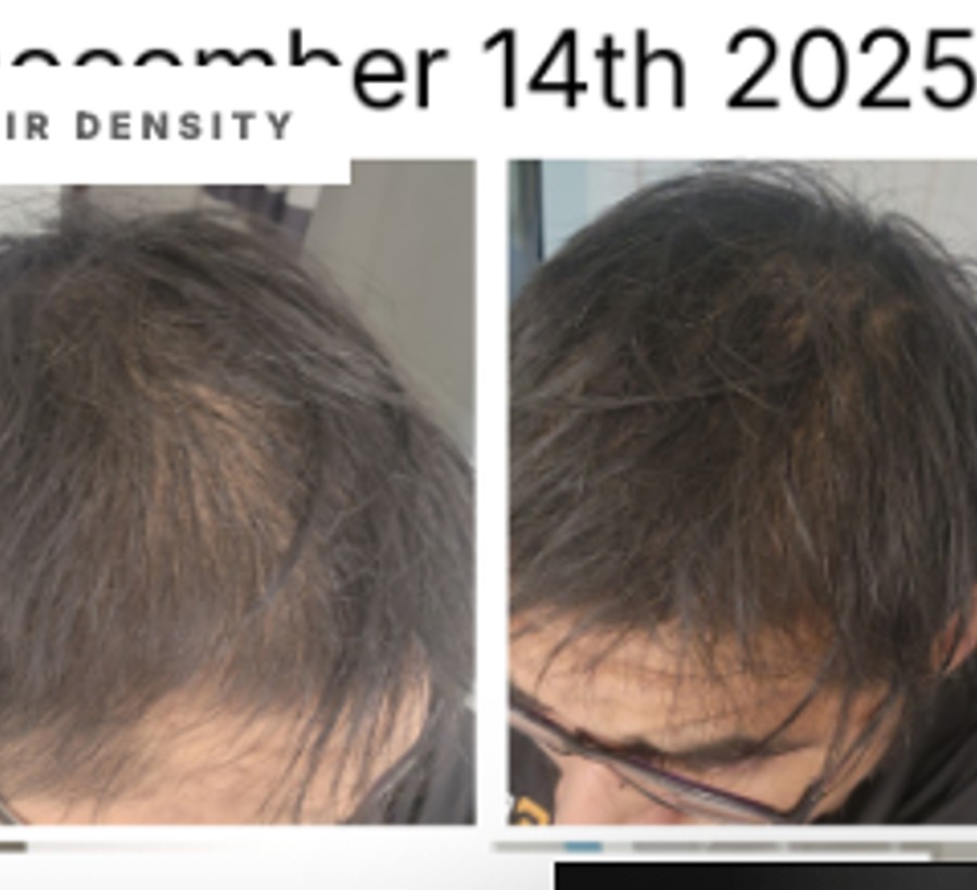 GHK-Cu hair Reddit source-board reference
