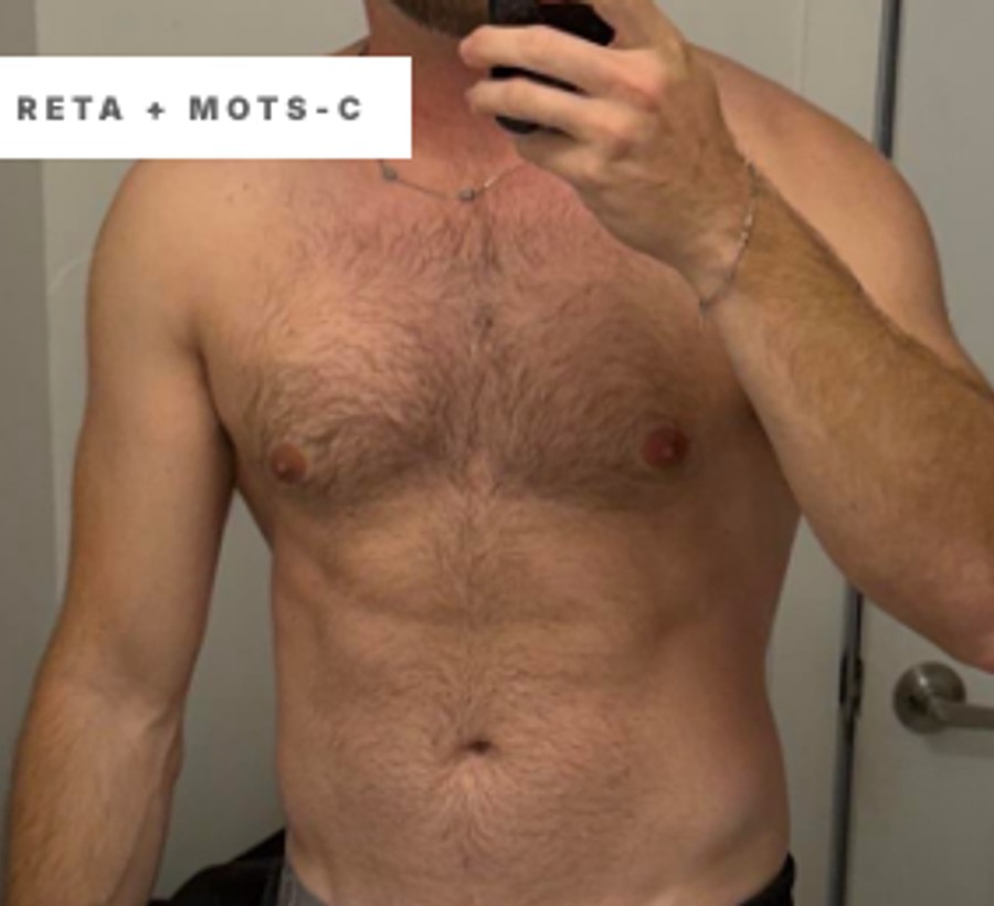 Reta + MOTS-C Reddit source-board reference